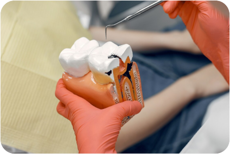 Root canal treatment