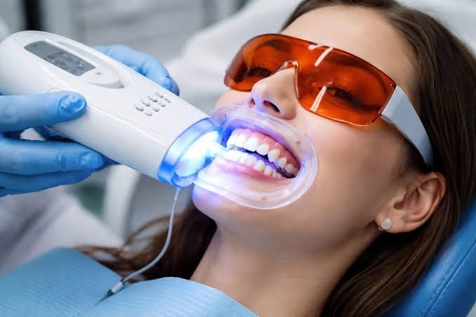 Teeth whitening
